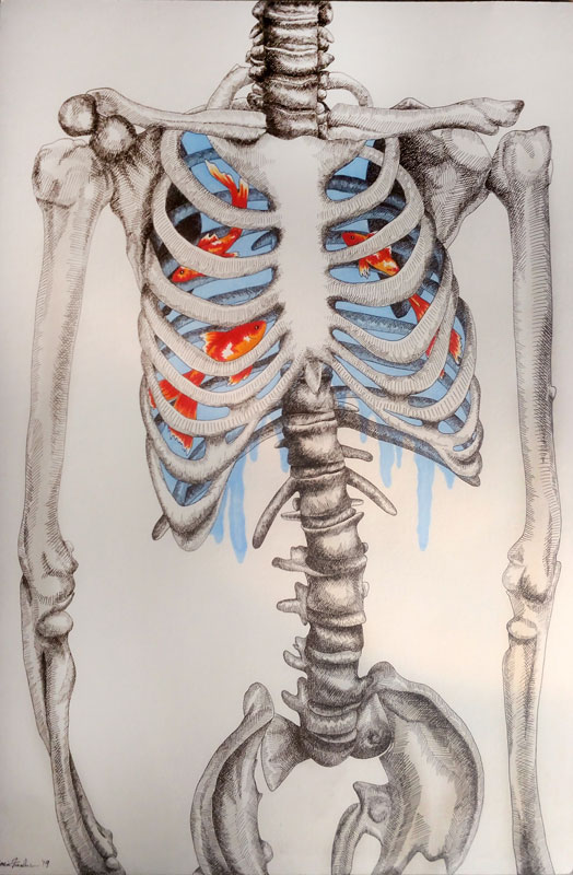 Joise Fasolino's artwork titled Piscis Pneumonia.
