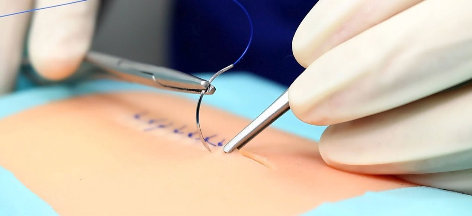 H-ton Freshman Peter Gaal Studies Sutures in Surgery
